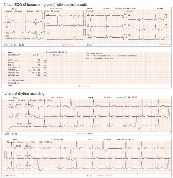 Máy điện tim 3 kênh Nihon Kohden ECG-3150